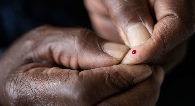 Billede af en hånd med en bloddråbe fra fingeren