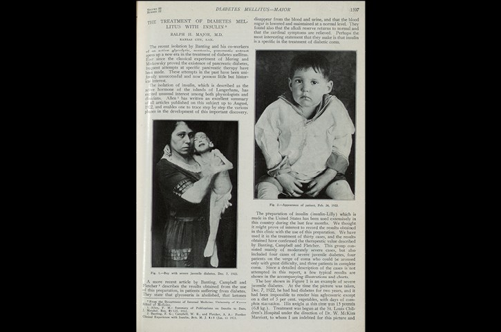 Arkivfoto af en artikel om en dreng, der fik insulinbehandling