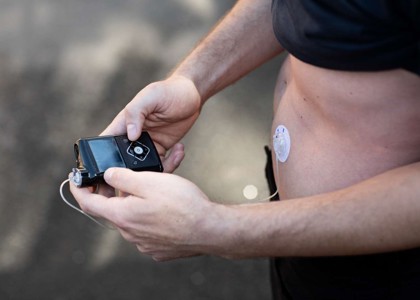 Billede af en insulinpumpe, der er sat på maven af en person.