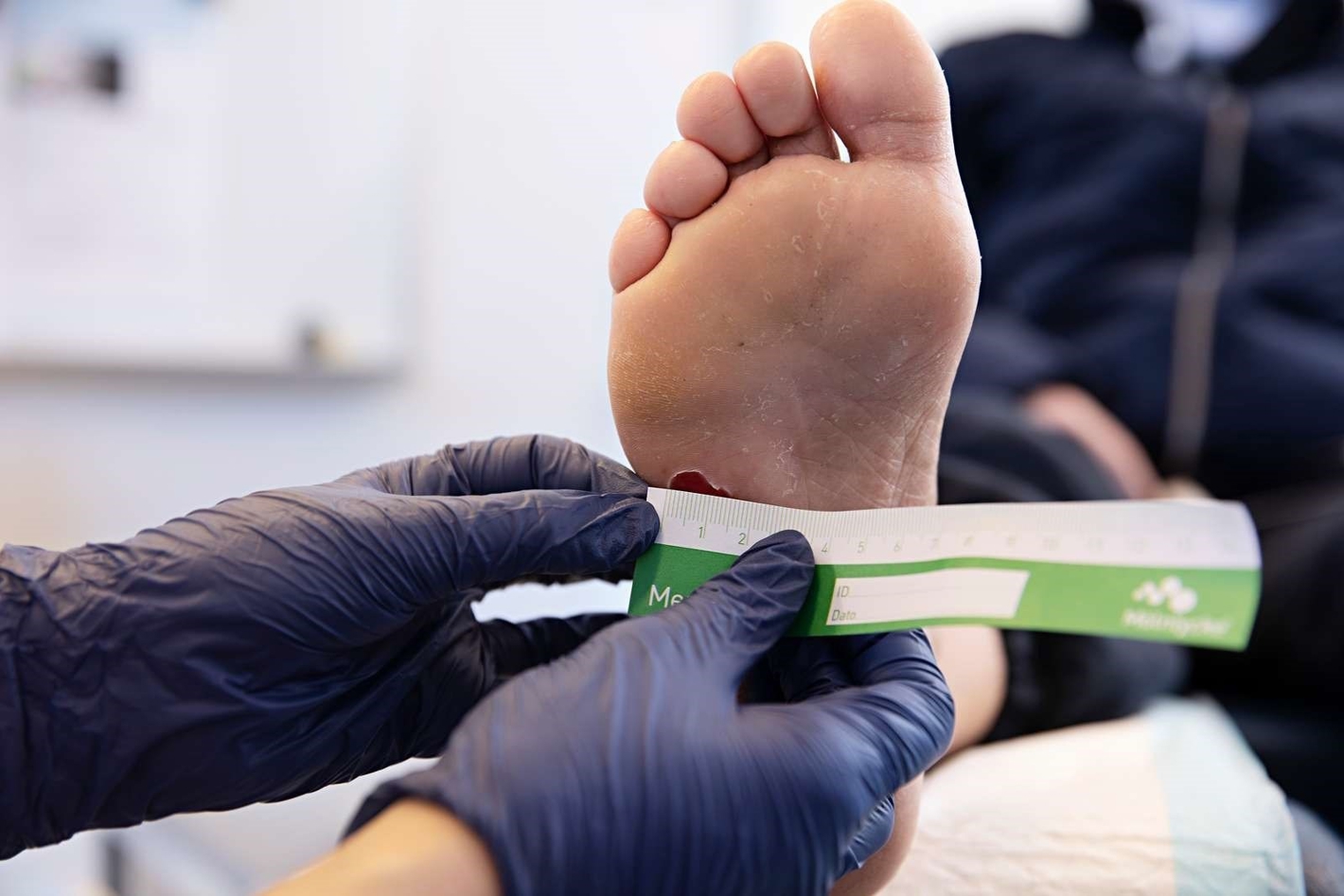 Billede af en fodsål, hvor der bliver målt størrelse på fodsår